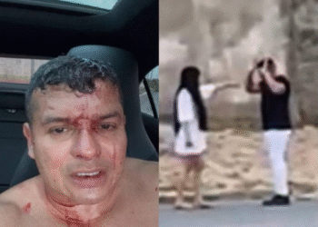 Policial é monitorado por agressão à ex-namorada