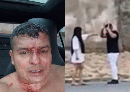 Policial é monitorado por agressão à ex-namorada